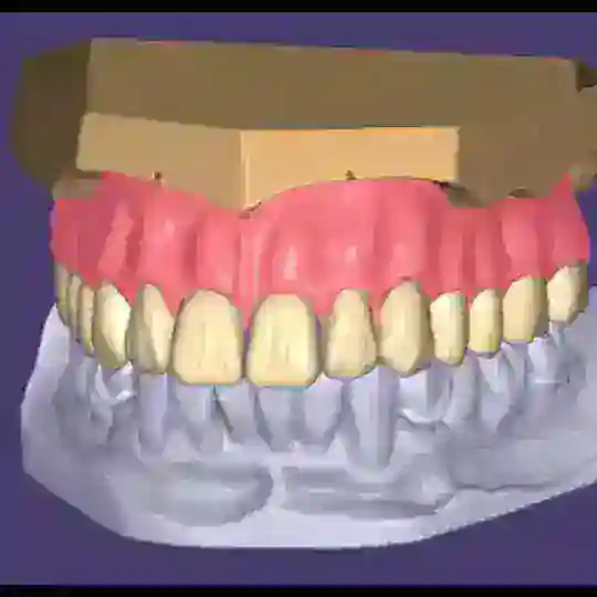 exocad-3shape-cerec expert