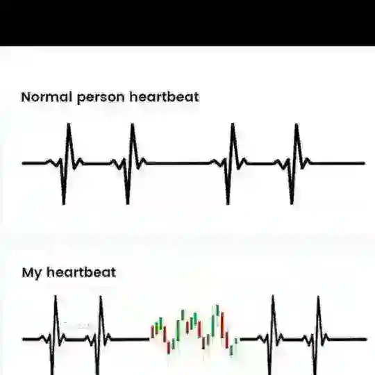 STOCK OPTION EARNING